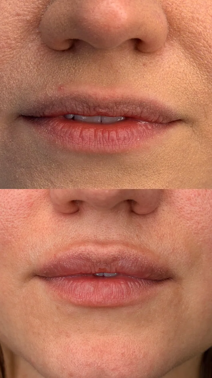 Client result 2: Before and After