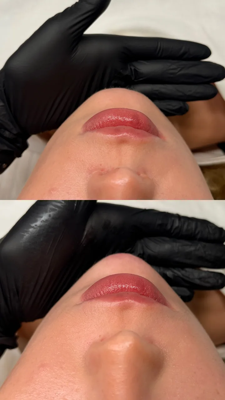 Client result 4: Before and After
